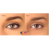 xoa-xam-mi-mat-1 xoa-xam-mi-mat-1